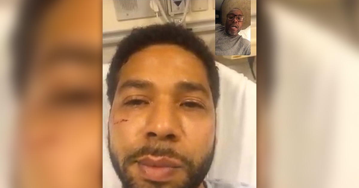 jussie-smollett-facial-bruises-after-attack.jpg