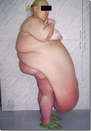 Russian%20woman%20Natalya%20M%20belly%20fat%20picture%5B3%5D.jpg